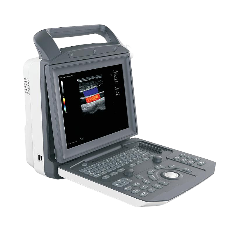 中旗 Zoncare 彩色多普勒超声系统 ZONCARE-V5（主机+腹部探头）基本信息